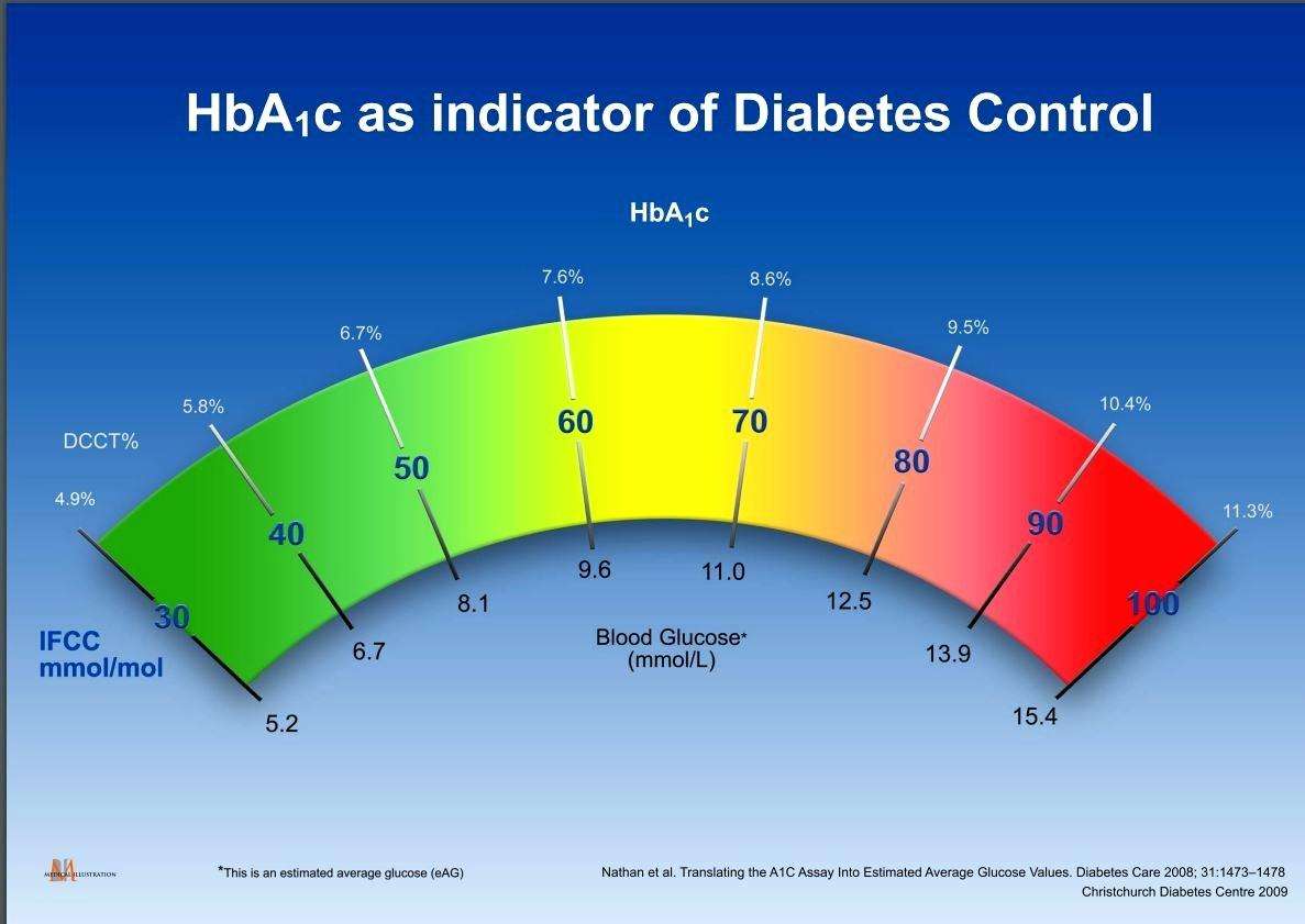 Analysis Of Hemoglobin A1C Levels In Blacks Whites Reveals Racial Differences In Diabetes